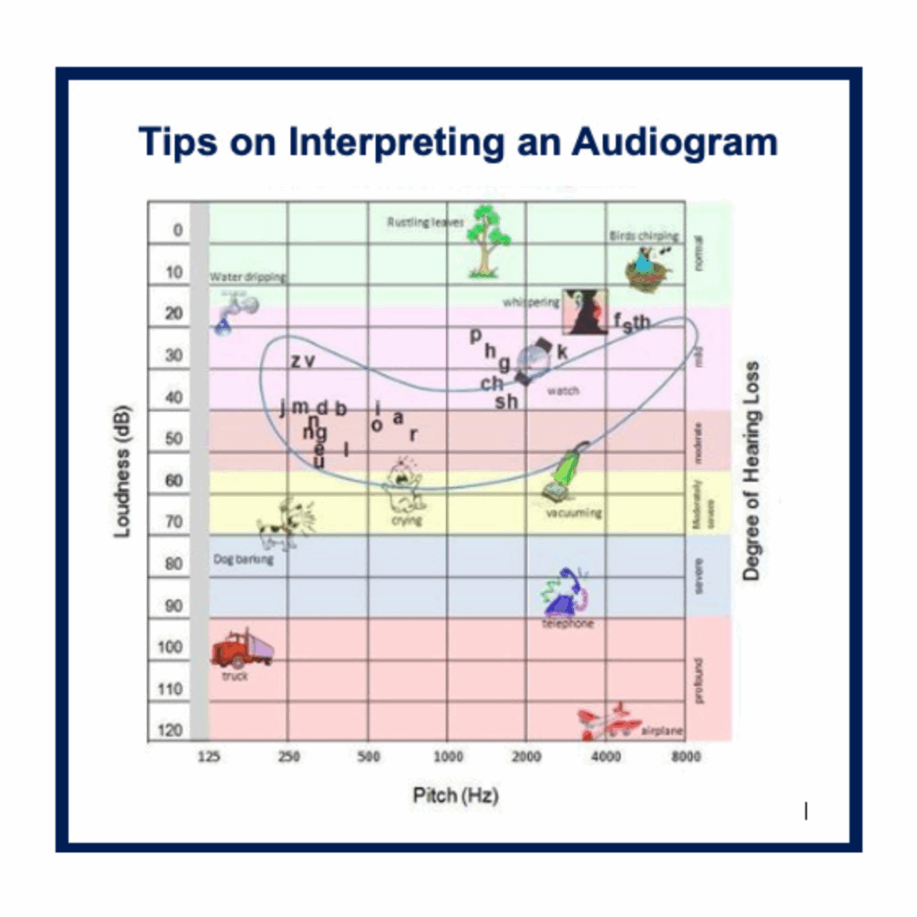 An audiogram with Loudness (dB) on the x-axis, Pitch (Hz) on the y-axis, and colors showing the degree of hearing loss.